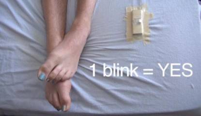 1 Blink Yes